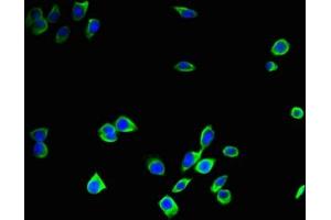 Immunofluorescent analysis of A375 cells using ABIN7146996 at dilution of 1:100 and Alexa Fluor 488-congugated AffiniPure Goat Anti-Rabbit IgG(H+L) (Cathepsin B antibody  (AA 82-333))