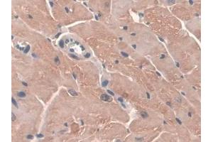 Detection of GPX3 in Mouse Heart Tissue using Polyclonal Antibody to Glutathione Peroxidase 3, Plasma (GPX3) (GPX3 antibody  (AA 3-72))