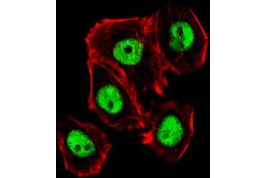 Fluorescent image of A431 cells stained with Mouse Ctr9 Antibody (C-term) (ABIN6243851 and ABIN6577807).