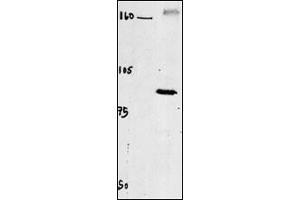 Western blot of chicken brain tissue incubated with CLC4 Antibody (C-term) f. (CLCN4 antibody  (C-Term))