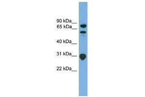 SH3KBP1 antibody used at 1 ug/ml to detect target protein. (SH3KBP1 antibody  (N-Term))