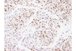 Immunohistochemistry (IHC) image for anti-Matrin 3 (MATR3) (C-Term) antibody (ABIN7448986) (MATR3 antibody  (C-Term))