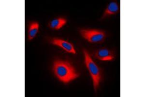 Immunofluorescent analysis of MKK1/2 (pS222/226) staining in K562 cells. (MEK1 antibody  (pSer222, pSer226))