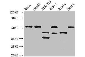 Western Blot Positive WB detected in: Hela whole cell lysate, HepG2 whole cell lysate, NIH/3T3 whole cell lysate, MCF-7 whole cell lysate, Mouse brain tissue, Rat heart tissue All lanes: LAX1 antibody at 2. (LAX1 antibody  (AA 107-298))