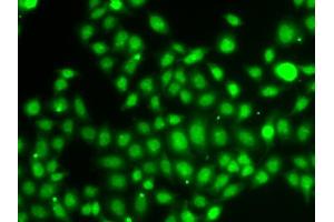 Immunofluorescence analysis of A549 cells using TXNL4B antibody (ABIN5974279). (TXNL4B antibody)