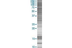 PHOX2A transfected lysate. (PHOX2A 293T Cell Transient Overexpression Lysate(Denatured))