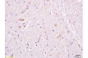 Formalin-fixed and paraffin embedded rat brain tissue labeled withAnti-Tuberin/TSC2 Polyclonal Antibody, Unconjugated (ABIN701200) at 1:200, followed by conjugation to the secondary antibody and DAB staining (Tuberin antibody  (AA 1601-1750))
