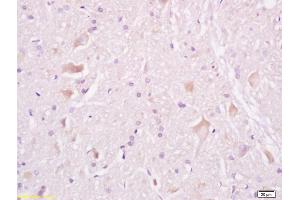 Formalin-fixed and paraffin embedded rat brain tissue labeled withAnti-Tuberin/TSC2 Polyclonal Antibody, Unconjugated (ABIN701200) at 1:200, followed by conjugation to the secondary antibody and DAB staining (Tuberin antibody  (AA 1601-1750))
