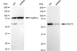 Western blotting analysis using CDC73 antibody (ABIN7799734).