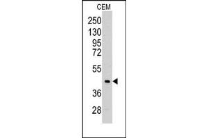 Image no. 1 for anti-Aldolase C, Fructose-Bisphosphate (ALDOC) (C-Term) antibody (ABIN357882) (ALDOC antibody  (C-Term))
