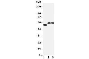 Western blot testing of SLC1A4 antibody and Lane 1:  human U87;  2: rat brain;  3: mouse brain tissue lysate. (SLC1A4 antibody  (C-Term))