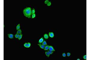 Immunofluorescent analysis of PC-3 cells cells using ABIN7146207 at dilution of 1:100 and Alexa Fluor 488-congugated AffiniPure Goat Anti-Rabbit IgG(H+L) (Cadherin 12 antibody  (AA 56-605))