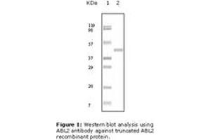 Image no. 1 for anti-ABL2 (ABL2) antibody (ABIN230671) (ABL2 antibody)