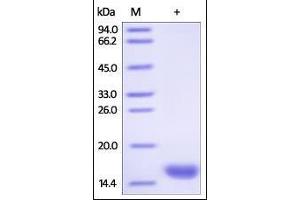 Human FABP3, His Tag on SDS-PAGE under reducing (R) condition. (FABP3 Protein (AA 1-133) (His tag))