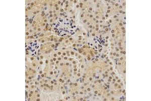 Immunohistochemistry (IHC) image for anti-BMI1 Polycomb Ring Finger Oncogene (BMI1) (AA 120-326) antibody (ABIN3020691)