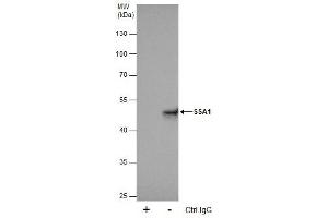IP Image Immunoprecipitation of SSA1 protein from 293T whole cell extracts using 5 μg of SSA1 antibody [C1C3], Western blot analysis was performed using SSA1 antibody [C1C3], EasyBlot anti-Rabbit IgG  was used as a secondary reagent. (TRIM21 antibody)