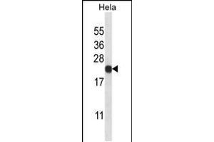 Western blot analysis in Hela cell line lysates (35ug/lane). (PSMB5 antibody  (C-Term))