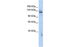 WB Suggested Anti-ZMYND8 Antibody Titration:  0. (ZMYND8 antibody  (Middle Region))
