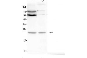 Western blot analysis of LMO2 using anti-LMO2 antibody .