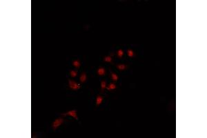 ABIN6269348 staining Jurkat cells by IF/ICC. (BIK antibody)