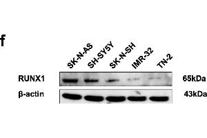 Identification of RUNX1 as an apoptosis transcription factor and an independent prognostic factor in NB tissue and cell lines. (RUNX1 antibody  (AA 221-480))