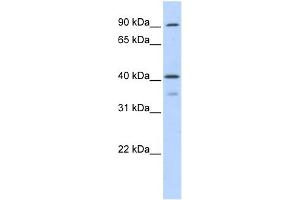 WB Suggested Anti-OAS1 Antibody Titration:  0.