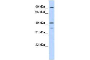 WB Suggested Anti-OAS1 Antibody Titration:  0. (OAS1 antibody  (Middle Region))