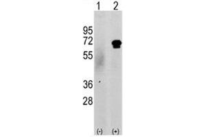 Western blot analysis of CAMKK2 antibody and 293 cell lysate either nontransfected (c) or transiently transfected with the CAMKK2 gene (2). (CAMKK2 antibody  (AA 52-82))