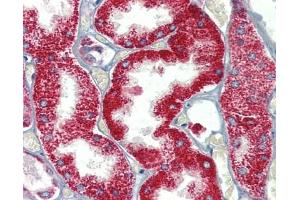 SH3BP2 antibody was used for immunohistochemistry at a concentration of 4-8 ug/ml. (SH3BP2 antibody  (Middle Region))