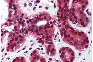 Human Breast (formalin-fixed, paraffin-embedded) stained with TP73 antibody ABIN290398 at 5 ug/ml followed by biotinylated goat anti-rabbit IgG secondary antibody ABIN481713, alkaline phosphatase-streptavidin and chromogen. (Tumor Protein p73 antibody  (AA 75-125))