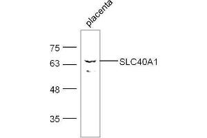 Mouse placenta lysates probed with Rabbit Anti- Polyclonal Antibody, Unconjugated  at 1:500 for 90 min at 37˚C. (SLC40A1 antibody  (AA 331-430))