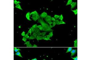 Immunofluorescence analysis of A549 cells using Rad51D Polyclonal Antibody (RAD51D antibody)