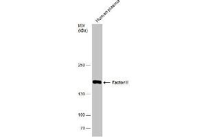 WB Image Human tissue extract (30 μg) was separated by 5% SDS-PAGE, and the membrane was blotted with Factor H antibody [N3C1], Internal , diluted at 1:500. (Complement Factor H antibody)