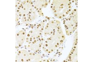 Immunohistochemistry (Paraffin-embedded Sections) (IHC (p)) image for anti-Acidic (Leucine-Rich) Nuclear phosphoprotein 32 Family, Member A (ANP32A) (AA 1-170) antibody (ABIN6136909)