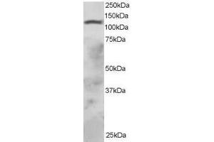 Image no. 1 for anti-Ring Finger Protein 31 (RNF31) (AA 908-921) antibody (ABIN297591) (RNF31 antibody  (AA 908-921))