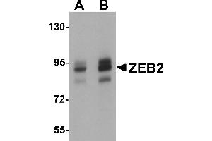 Western Blotting (WB) image for anti-Zinc Finger E-Box Binding Homeobox 2 (ZEB2) (C-Term) antibody (ABIN1030819) (ZEB2 antibody  (C-Term))