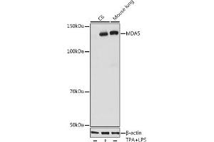 Western blot analysis of extracts of various cell lines, using MD antibody (ABIN7267950) at 1:1000 dilution. (IFIH1 antibody)
