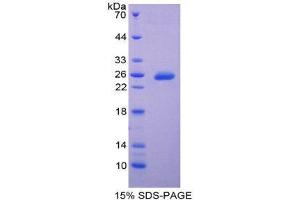 SDS-PAGE (SDS) image for TIMP Metallopeptidase Inhibitor 3 (TIMP3) (AA 31-209) protein (His tag) (ABIN2126970)