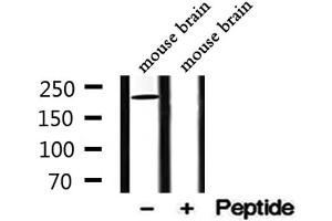 Western blot analysis of extracts from mouse brain, using DENND4A Antibody. (DENND4A antibody  (Internal Region))