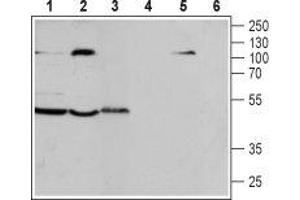 Western blot analysis of human T-cell leukemia Jurkat cell line (lanes 1 and 4), human acute lymphoblastic leukemia MOLT-4 (lanes 2 and 5) and mouse macrophage J774. (CCR7 antibody  (Extracellular, N-Term))
