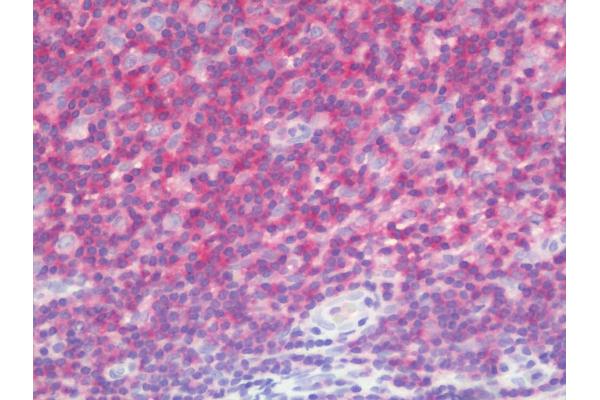 LRCH4 antibody