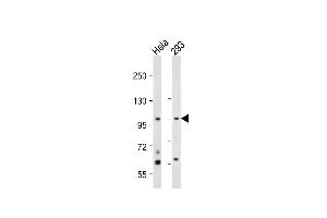 All lanes : Anti-hNEK4- at 1:2000 dilution Lane 1: Hela whole cell lysate Lane 2: 293 whole cell lysate Lysates/proteins at 20 μg per lane. (NEK4 antibody  (C-Term))