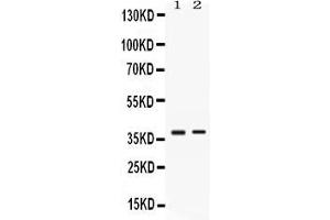 Western blot analysis of TNFRSF14/HVEM expression in HELA whole cell lysates ( Lane 1) and SW620 whole cell lysates ( Lane 2). (HVEM antibody  (AA 39-202))