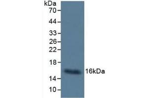 Detection of Cys-C in Human Urine using Monoclonal Antibody to Cystatin C (Cys-C) (CST3 antibody  (AA 27-146))