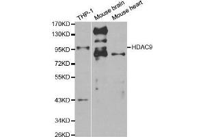 Western blot analysis of extracts of various cell lines, using HDAC9 antibody. (HDAC9 antibody  (AA 1-100))