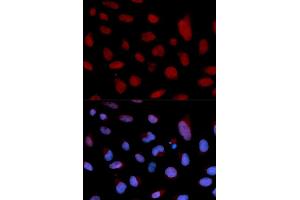 Immunofluorescence analysis of U2OS cell using TNNC1 antibody. (TNNC1 antibody)