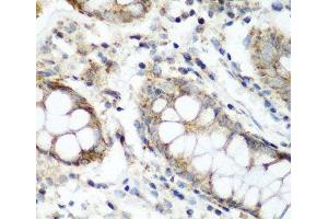 Immunohistochemistry of paraffin-embedded Human colon using NAA60 Polyclonal Antibody at dilution of 1:200 (40x lens). (NAT15 antibody)