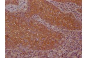 IHC image of ABIN7127495 diluted at 1:100 and staining in paraffin-embedded human tonsil tissue performed on a Leica BondTM system. (Recombinant FNTB antibody)