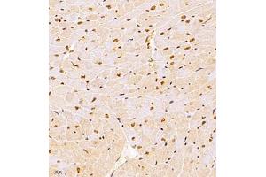 Immunohistochemistry of paraffin embedded rat heart using NSD3 (ABIN7076233) at dilution of 1:1400 (400x lens)