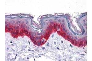 Immunohistochemistry (IHC) image for anti-Keratin 81 (KRT81) (AA 1-203) antibody (ABIN614629) (KRT81 antibody  (AA 1-203))